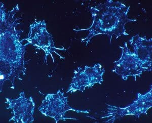 خلايا سرطانية, الذكاء الاصطناعي, تقنية, علاج السرطان