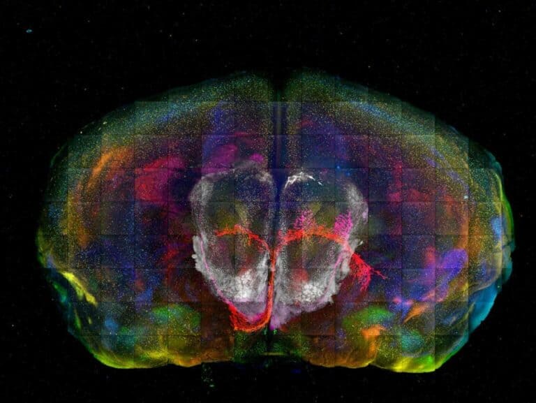 خرائط الدماغ
