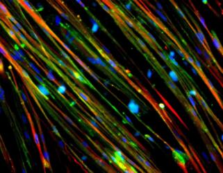 كيف يساعد تخطيط الخلايا البشرية في الكشف عن أسباب بعض الأمراض العضلية؟