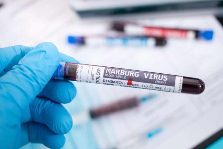 هل يشكل تفشي فيروس ماربورغ الفتاك خطراً جديداً على البشرية؟