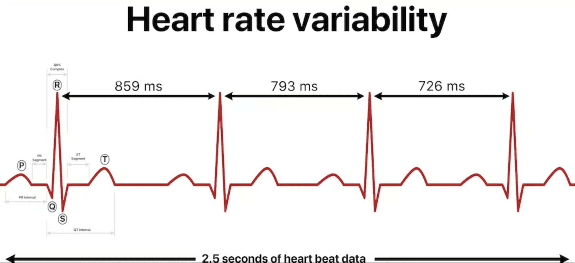 What you should know about heart rate variability–a biometric most fitness trackers measure