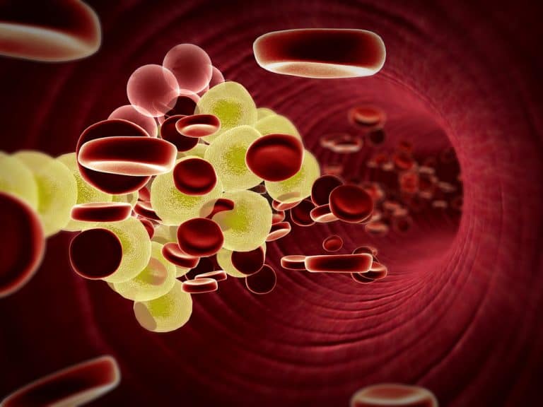 ما أعراض ارتفاع الكوليسترول في الدم؟