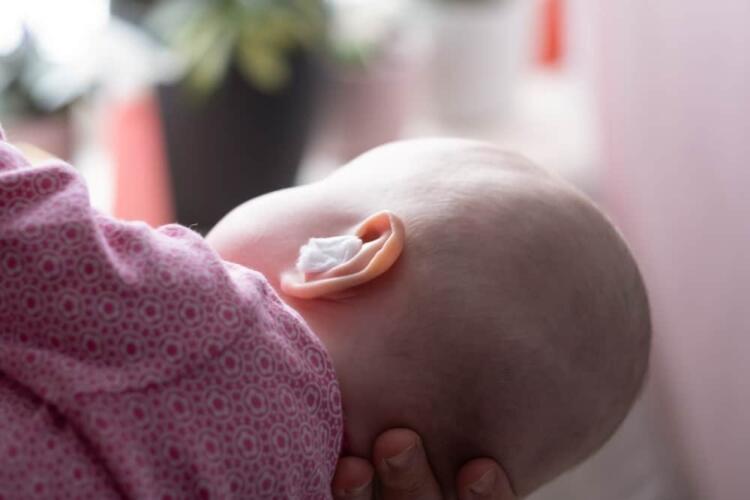 علاجات منزلية فعّالة لتخفيف ألم الأذن عند الأطفال