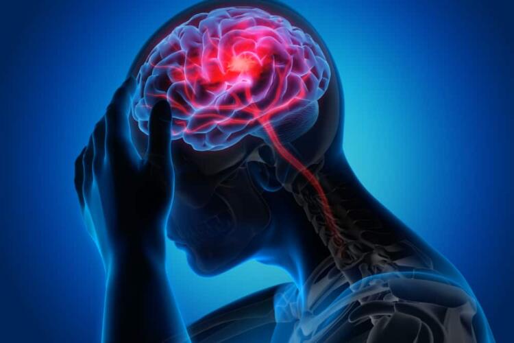 دراسة جديدة: اضطرابات النوم تضاعف خطر الإصابة بالسكتة الدماغية