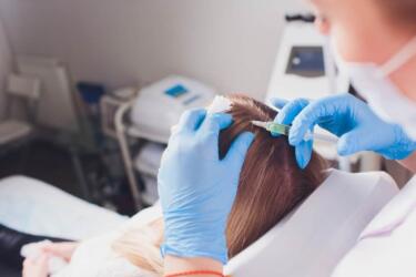 إليك أهم الفوائد والآثار الجانبية لإبر البلازما المستخدمة في علاج تساقط الشعر