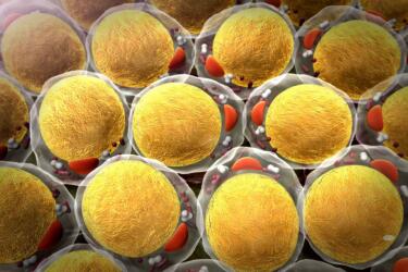 أين تذهب الخلايا الشحمية بعد إنقاص الوزن؟