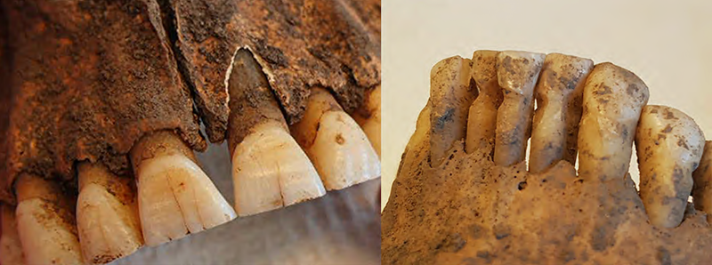 على اليمين: أسنان اكتشفت في أثناء التنقيب يبدو أنها بُردت. على اليسار: أدلة تبين أن الفرد الذي تعود له الأسنان خلّل أسنانه لتنظيفها على الأرجح. حقوق الصورة: كارولينا بيرتلسون.