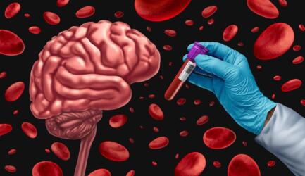 النجاح في الكشف عن سرطان الدماغ أول مرة عن طريق تحليل الدم
