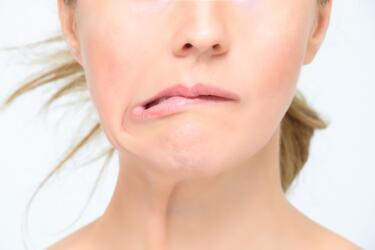 ما هو شلل العصب الوجهي (اللقوة)؟ وما أساليب علاجه والوقاية منه؟
